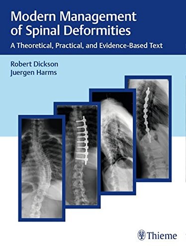 Modern management of spinal deformities : a theoretical, practical, and evidence-based text