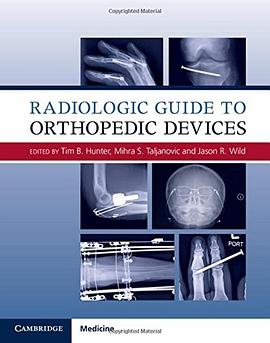 Radiologic guide to orthopedic devices