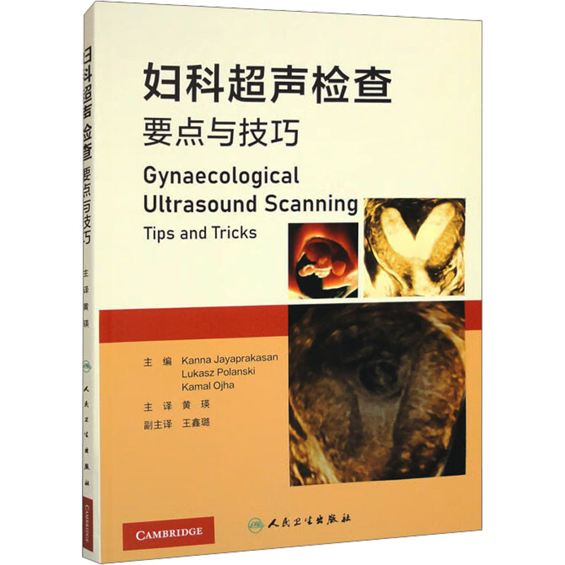 妇科超声检查要点与技巧 影像学